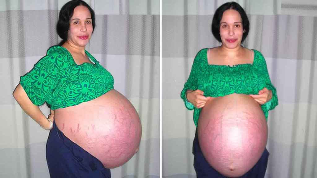 Image result for octomom pregnant